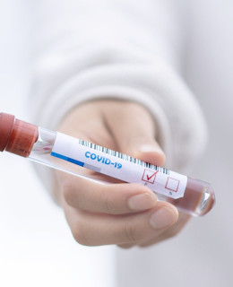 test covid 19 ai donatori di sangue